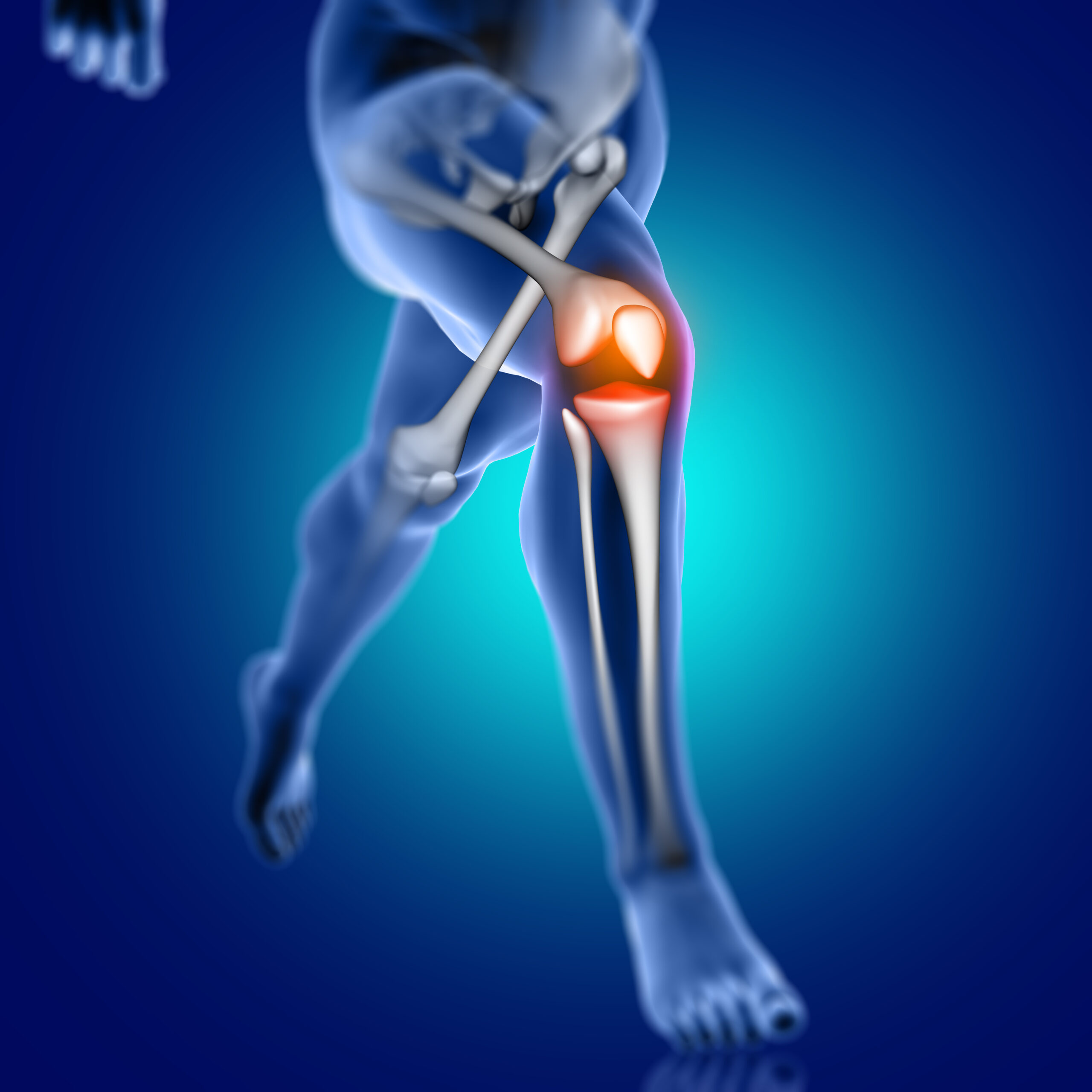 3d male medical figure running with knee bone highlighted scaled