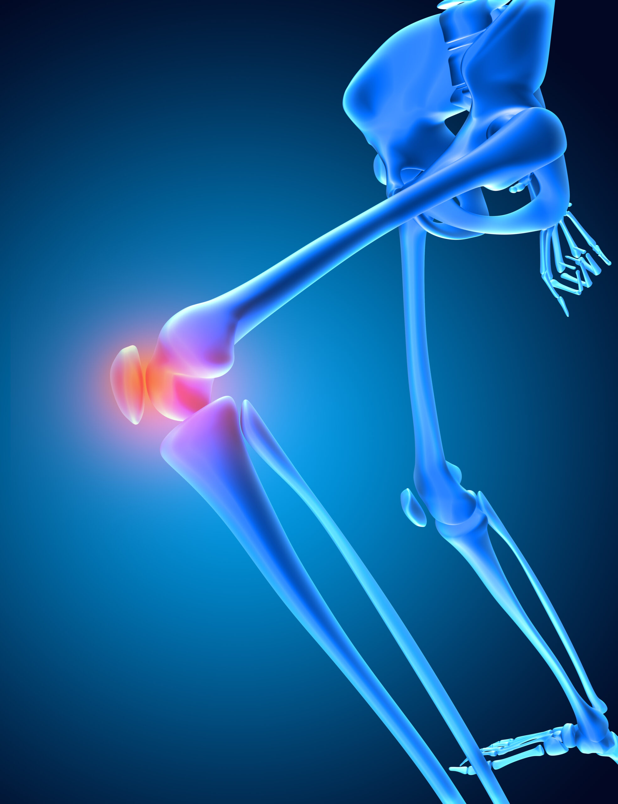 3d render medical image skeleton with knee bone highlighted scaled