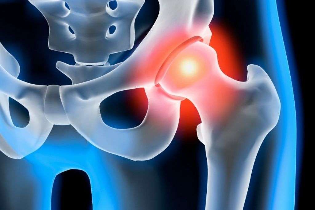 Hip Preservation Treatment